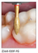 ABACUS® Diamantinstrument, Оливка Z368-020C-FG 2748